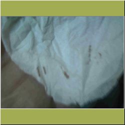 dannys-blood-from-head.jpg